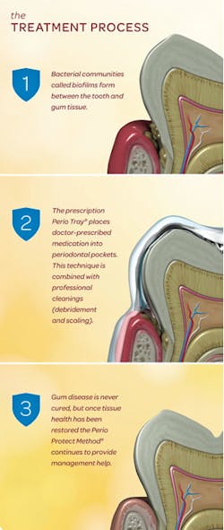 Treatment Process Treatment Process