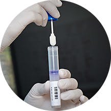 Tube Genes Fo Tube Genes Fo