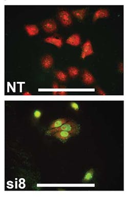 Um Trip13 Fig 2g Um Trip13 Fig 2g