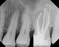 Upperoriginal Upperoriginal