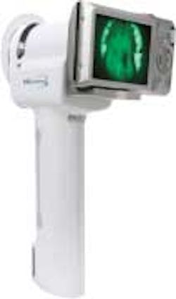 Velscope1 Fo Velscope1 Fo