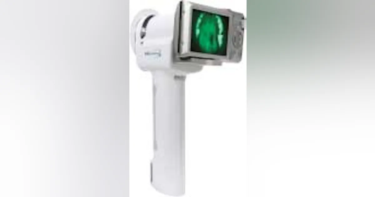 Velscope Kit VELscope is a non-invasive oral cancer-screening device | Dentistry IQ