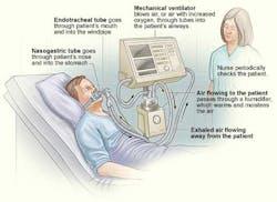 Ventilators Fo Ventilators Fo