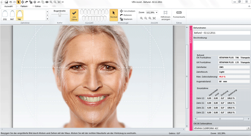 Vita Tooth Config Thumb
