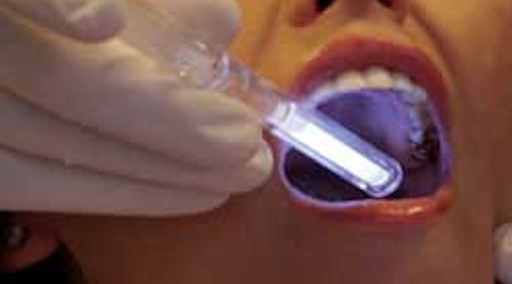 Vizilite Oral Cancer Screening Aspen Dental