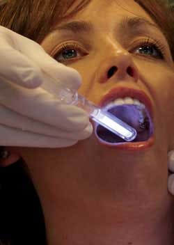 Vizilite Oral Cancer Screening Aspen Dental