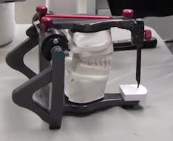 Whip Mix Anterior Guide Table Whip Mix Anterior Guide Table