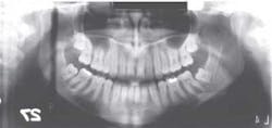 Xray Xray