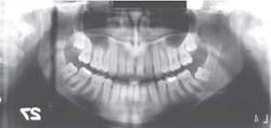 Xray Xray