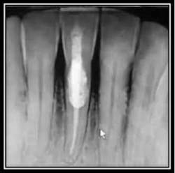 Xray Geristore 3 Xray Geristore 3