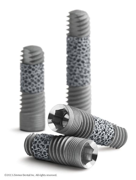Zimmer's new 3.7 mmD Trabecular Metal dental implant | Dentistry IQ