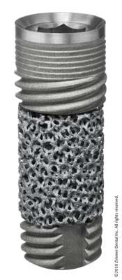 Zimmer Osseo Es Zimmer Osseo Es