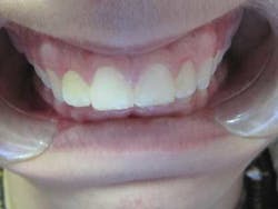 16jan7bcbunker01 16jan7bcbunker01