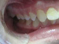 16jan7bcbunker02 16jan7bcbunker02