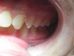 16jan7bcbunker03 16jan7bcbunker03