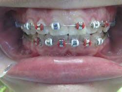 16jan7bcbunker04 16jan7bcbunker04