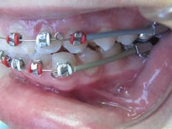 16jan7bcbunker05 16jan7bcbunker05