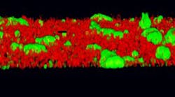 Content Dam Diq Online Articles 2016 01 Uol Biofilm 1 Thumb Content Dam Diq Online Articles 2016 01 Uol Biofilm 1 Thumb
