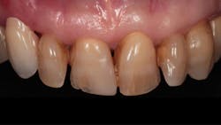 Optiglaze Fig01 Optiglaze Fig01