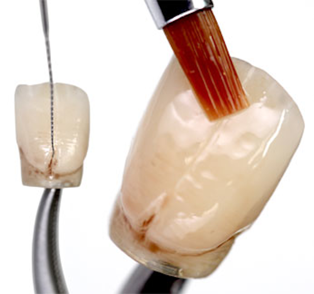 So easy, a prosthodontist can do it A simple and costeffective method for characterizing