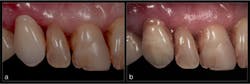 Optiglaze Fig09 Optiglaze Fig09