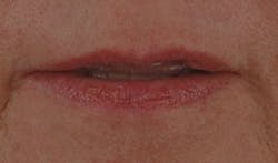 Ross Photog Fig21 Final Ross Photog Fig21 Final