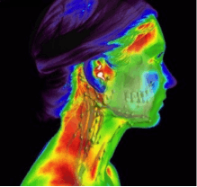 Thermography 01 Thermography 01