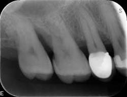 1601clinlong Perio Diabetes Lanap10 1601clinlong Perio Diabetes Lanap10