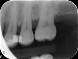 1601clinlong Perio Diabetes Lanap12 1601clinlong Perio Diabetes Lanap12