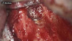 16feb04bc Mccormack06 16feb04bc Mccormack06