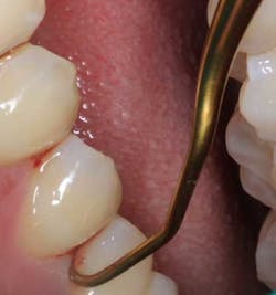 16feb04bc Nonsurgical Perio Tx01 16feb04bc Nonsurgical Perio Tx01