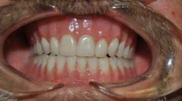 Content Dam Diq Online Articles 2016 02 16febdiqclin Article Thumbnail