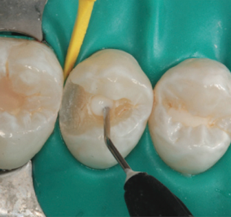 Content Dam Diq Online Articles 2016 02 Ca Lok Taub