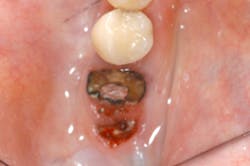 Mronj Hellstein Mronj Hellstein