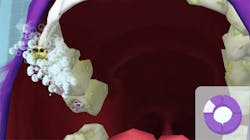 Pmm Smartbrushes Fig12 Pmm Smartbrushes Fig12