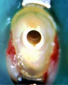 16mar03bc Deutsch Endo02 16mar03bc Deutsch Endo02