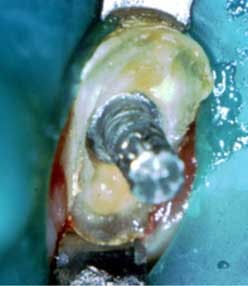 16mar03bc Deutsch Endo03 16mar03bc Deutsch Endo03