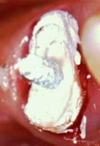 16mar03bc Deutsch Endo04 16mar03bc Deutsch Endo04