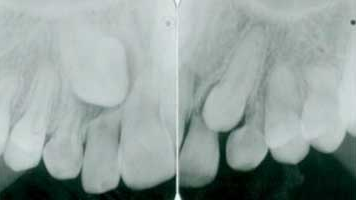 Content Dam Diq Online Articles 2016 03 16mar03bc Morneau Article Thumb