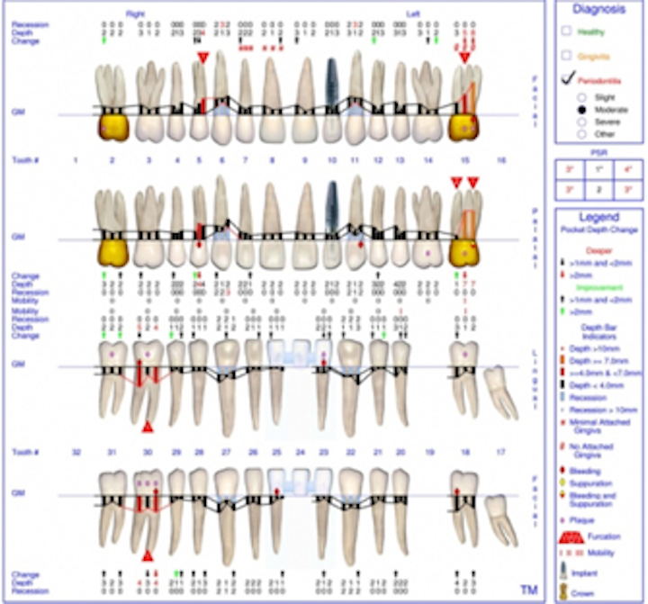 incorporating-risk-analysis-in-periodontal-assessment-florida-probe-voiceworks-dentistryiq