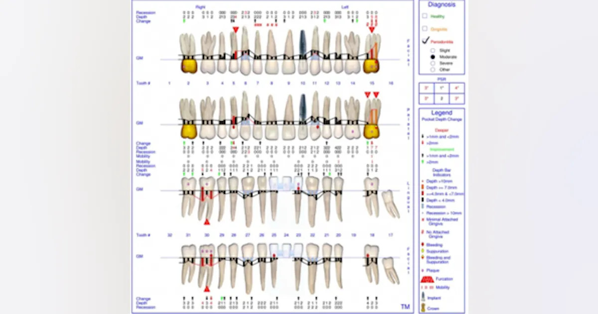 Auger Risk Assessment Incorporating risk analysis in periodontal assessment: Florida Probe ...