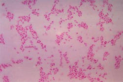 Bacteroides Fragilis Bacteroides Fragilis