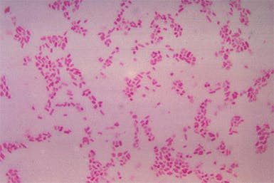 Bacteroides Fragilis