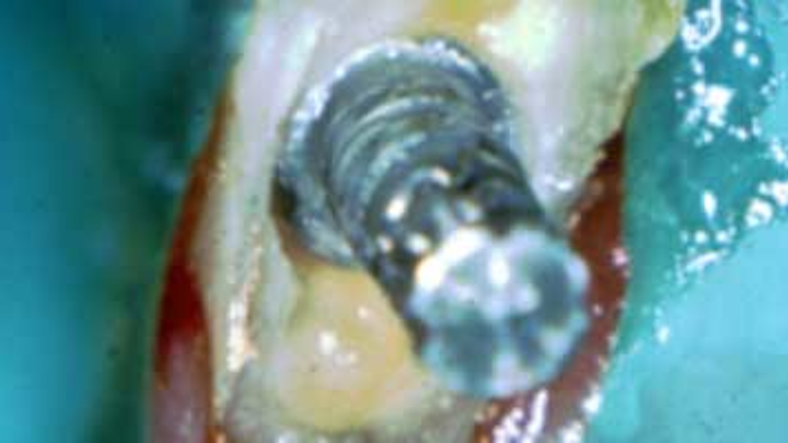 Content Dam Diq Online Articles 2016 03 16mar03bc Deutsch Endo Article Thumb