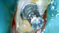 Content Dam Diq Online Articles 2016 03 16mar03bc Deutsch Endo Article Thumb Content Dam Diq Online Articles 2016 03 16mar03bc Deutsch Endo Article Thumb