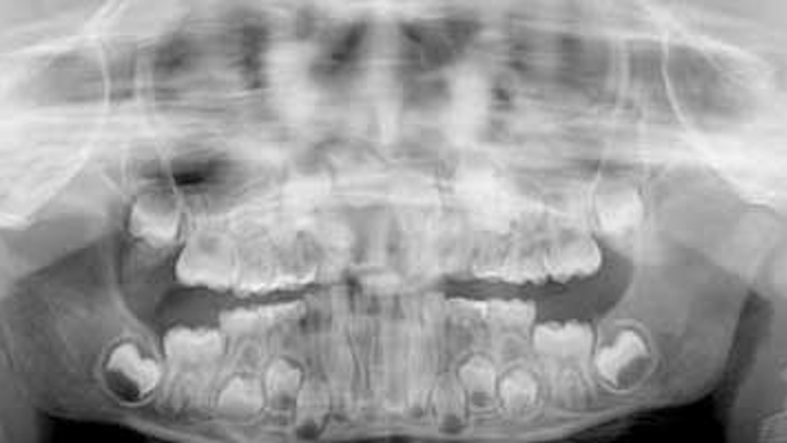 Content Dam Diq Online Articles 2016 03 16mar03bc Pathcase13 Simmons Article Thumb