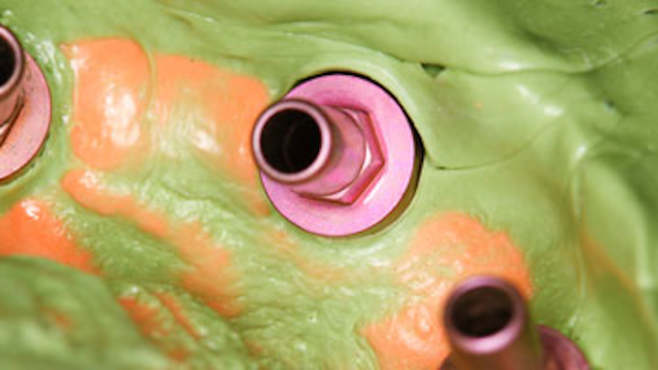 Content Dam Diq Online Articles 2016 03 Dental Implant Impression 1