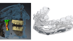 Content Dam Diq Site Images Rotator Images 2016 Sicat Optisleep Diqthumb Content Dam Diq Site Images Rotator Images 2016 Sicat Optisleep Diqthumb