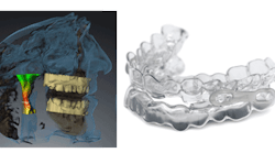 Content Dam Diq Site Images Rotator Images 2016 Sicat Optisleep Diqthumb Content Dam Diq Site Images Rotator Images 2016 Sicat Optisleep Diqthumb