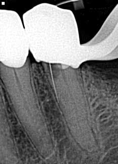 16apr7bcsimmons01 16apr7bcsimmons01